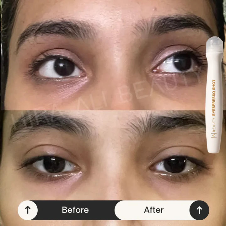 Under Eye Serum  For Dark Circles